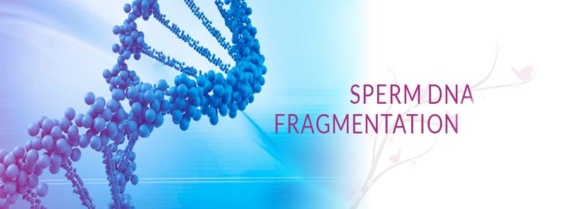 Xét nghiệm xác định mức độ phân mảnh DNA tinh trùng