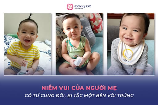 Chị Vũ Thu Phương mang trong mình dị dạng tử cung đôi rất hiếm gặp