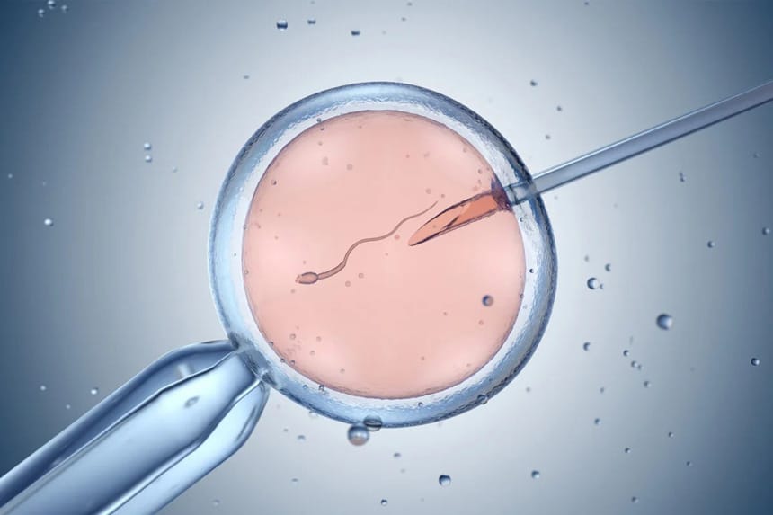 5+ điều cần thiết để chuẩn bị làm IVF, tăng cơ hội thụ thai thành công