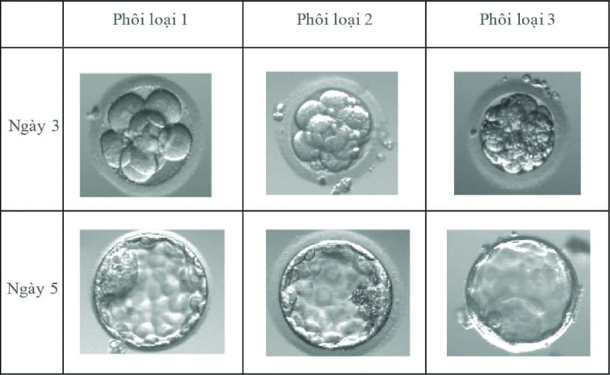 Các loại phôi