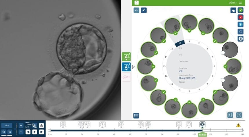 Công nghệ nuôi cấy phôi Timelapse tại Đông Đô IVF Center
