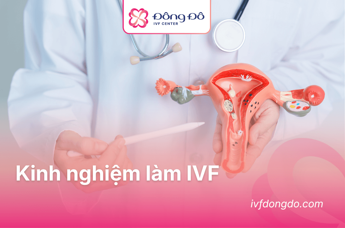 kinh nghiệm ivf