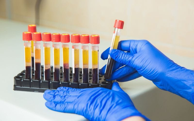 tiêm PRP khi làm IVF