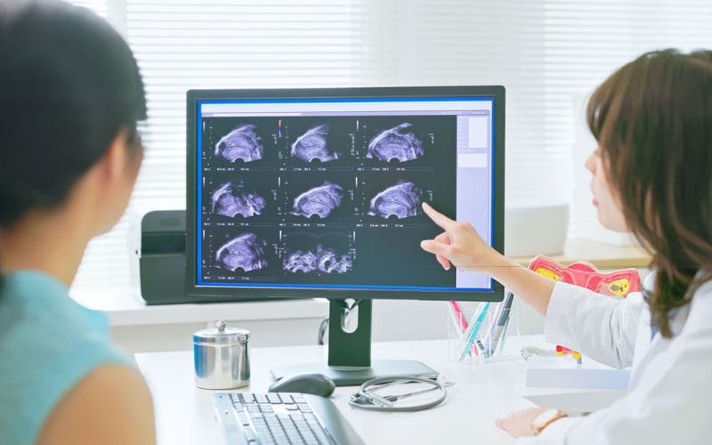 Các yếu tố ảnh hưởng đến khả năng mang thai tự nhiên sau IUI thất bại