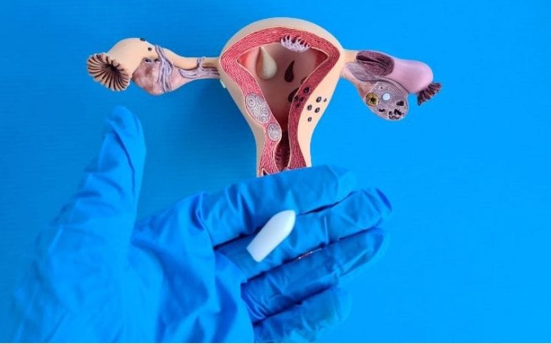 đặt thuốc sau iui có tác dụng gì