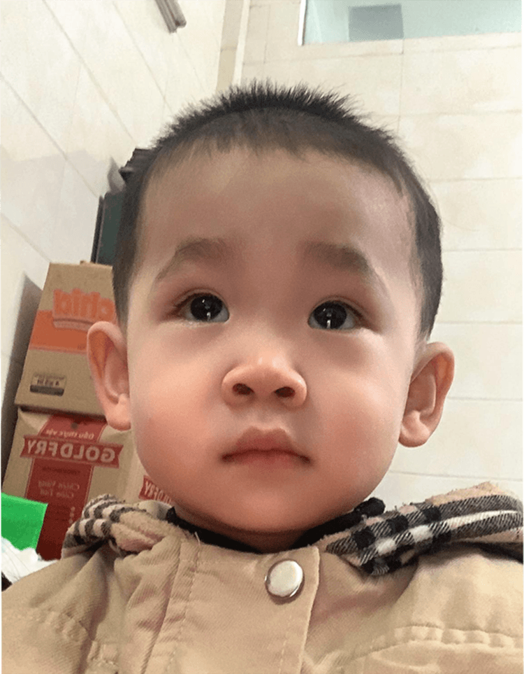 Cắt hai vòi trứng, đón song thai nhờ IVF lần 4