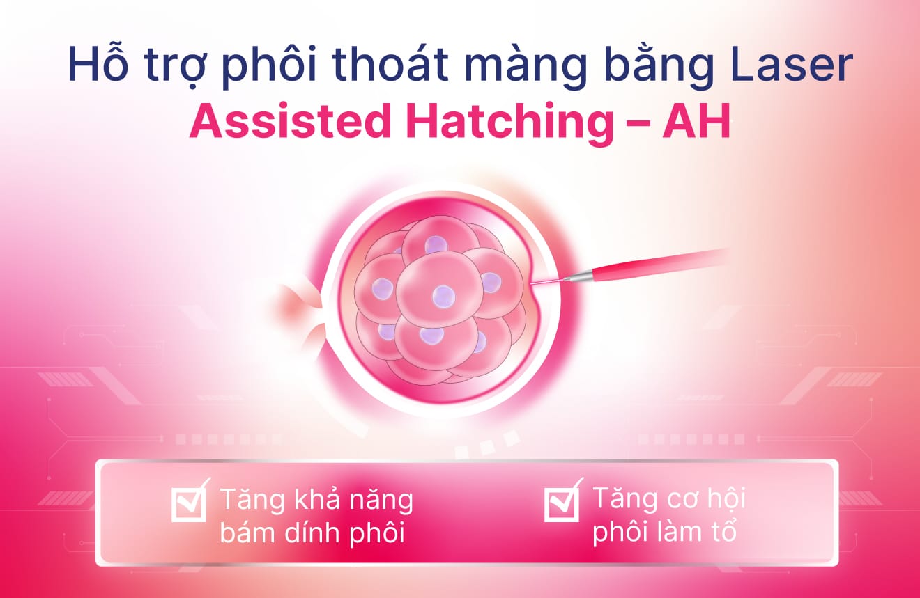 Hỗ trợ phôi thoát màng bằng Laser