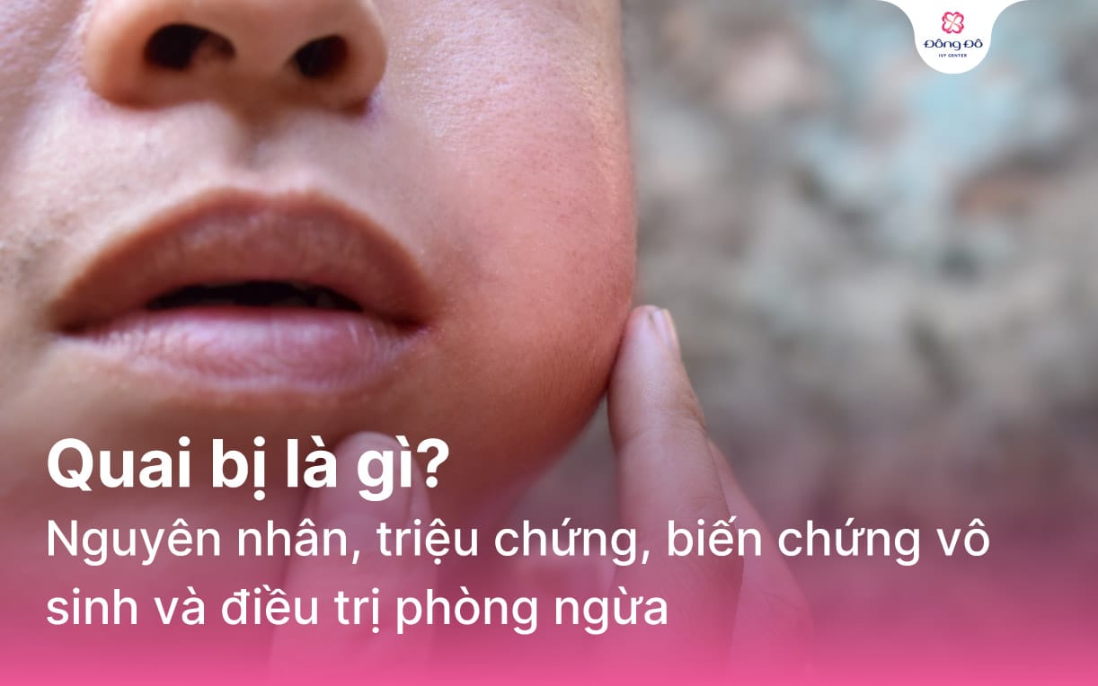 Quai bị là gì