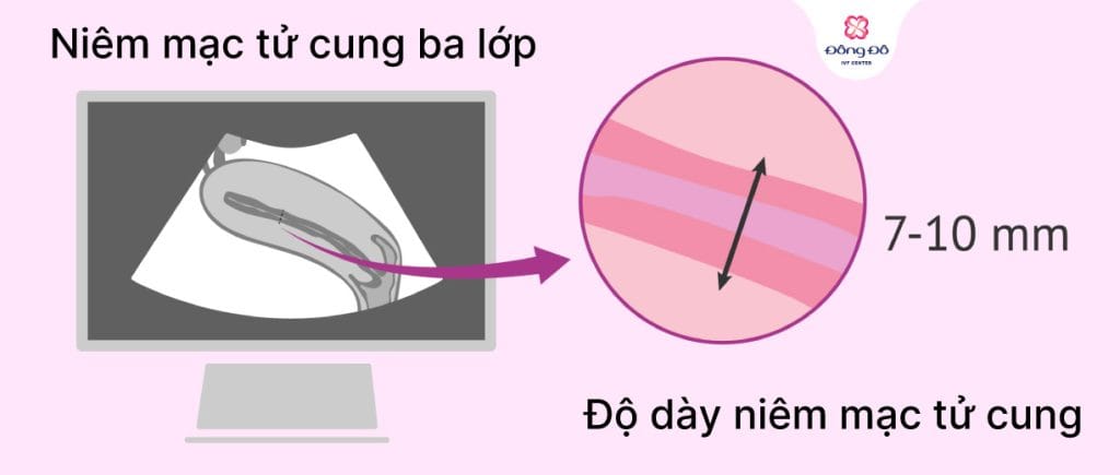 Hình dạng (phân loại hình ảnh trên siêu âm)