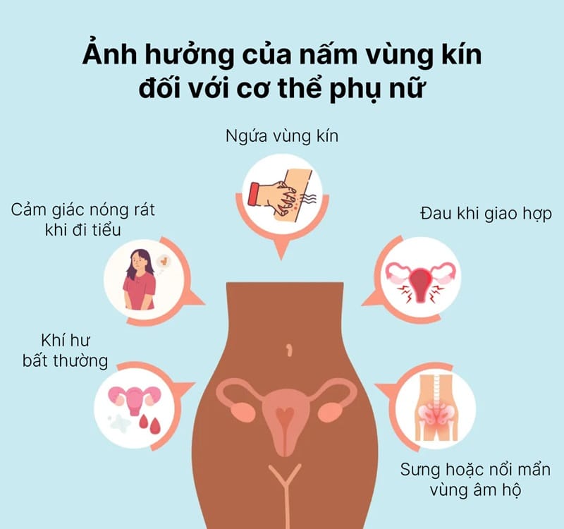 Dấu hiệu nhận biết nấm vùng kín ở nữ giới