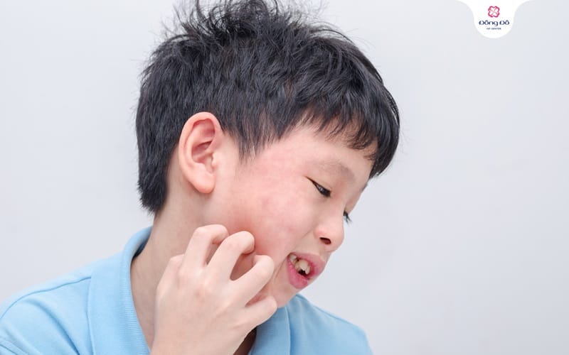 Quai bị là gì?