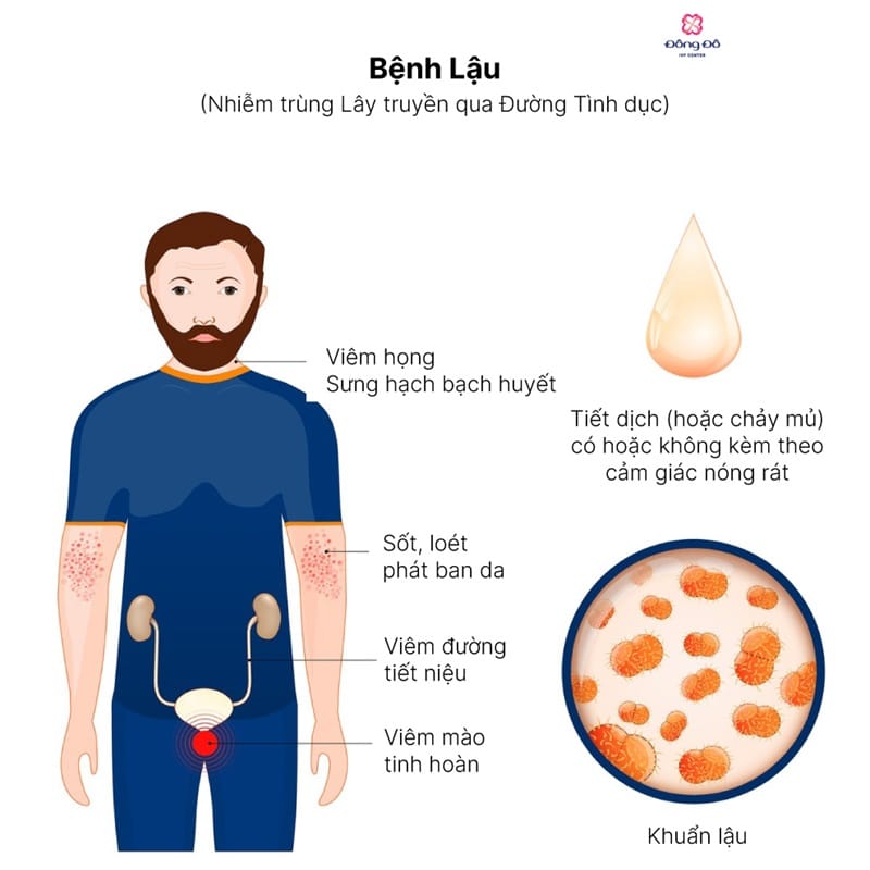 Nguyên nhân lây nhiễm lậu ở nam giới