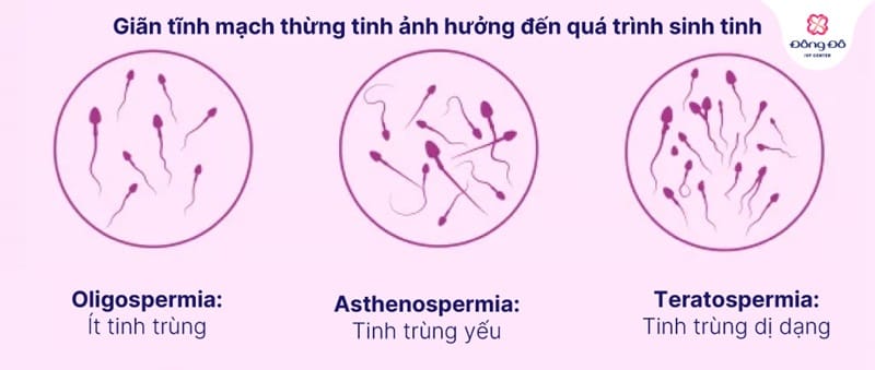 Nguyên nhân giãn tĩnh mạch thừng tinh ảnh hưởng đến tinh trùng