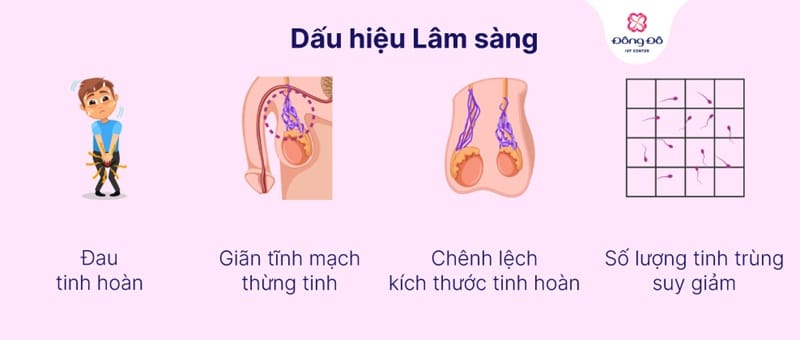Dấu hiệu nhận biết giãn tĩnh mạch thừng tinh