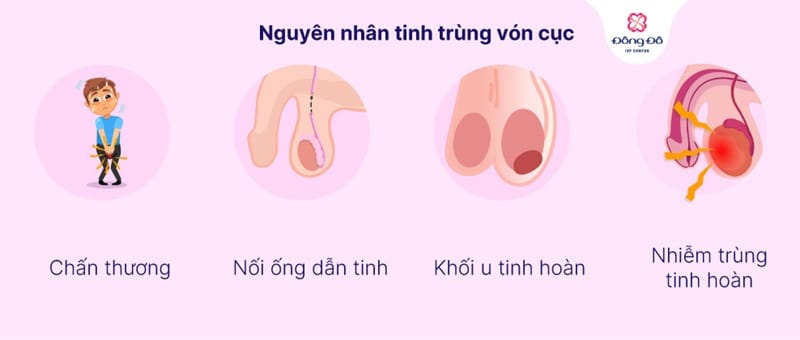 Nguyên nhân gây tinh trùng vón cục