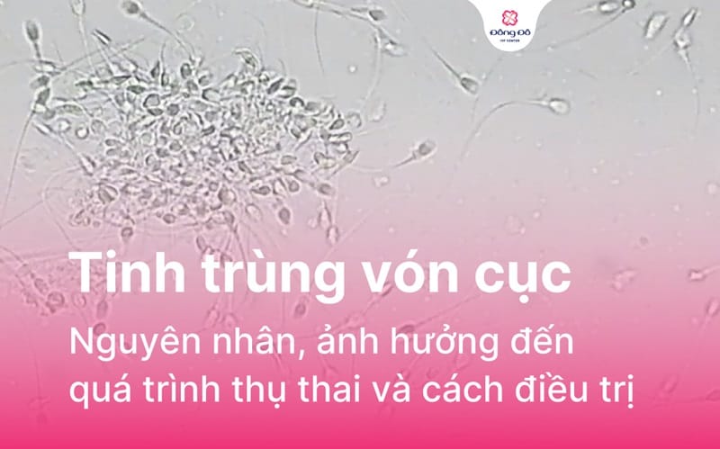 Tinh trùng vón cục là gì? Nguyên nhân và dấu hiệu bất thường