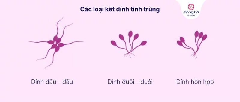 Tinh trùng vón cục có tự hết không?