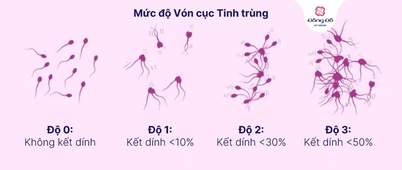 Dấu hiệu nhận biết tinh trùng vón cục