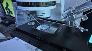 (Vietnamnet.vn) Phát hiện 41.000 trẻ mắc dị tật mỗi năm và ‘lối thoát’ từ sàng lọc gene