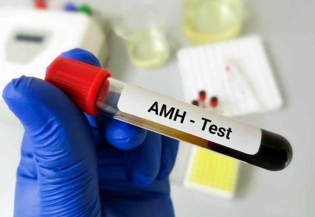 Chỉ số AMH thấp là gì?