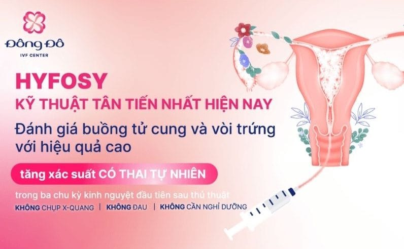 Hyfosy dần được ưa chuộng hơn HSG nhờ hình ảnh chính xác, không gây nhiễm xạ, ít đau và khó chịu hơn, có thể hỗ trợ làm sạch buồng tử cung và vòi trứng