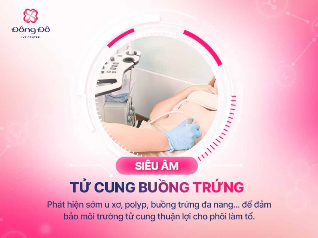 Siêu âm tử cung buồng trứng là 1 trong những xét nghiệm đầu tiên cần thực hiện trước khi làm IVF