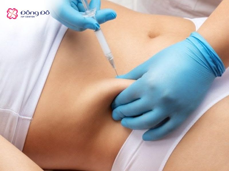 Mũi tiêm trưởng thành noãn được tiêm 36 giờ trước thủ thuật chọc hút noãn