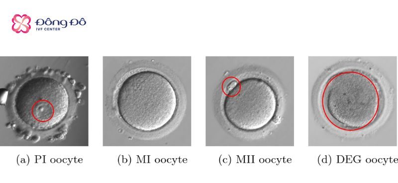 Một số trứng chưa đạt đến giai đoạn trưởng thành, không đạt về chất lượng, kích thước cần có
