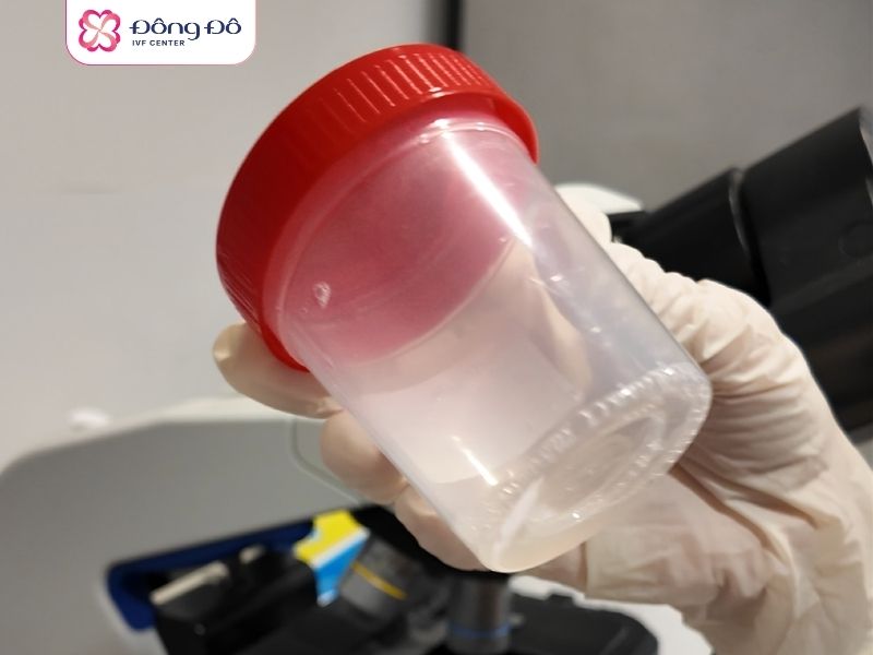 Quy tình lấy mẫu tinh trùng và xử lý tại Labo Đông Đô IVF Center