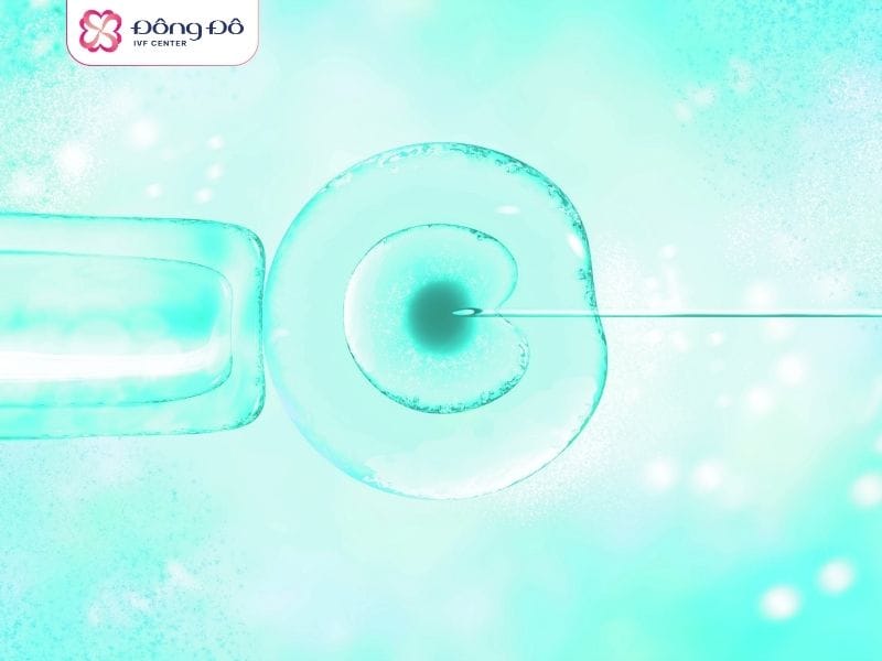 IVF ICSI là một trong những phương pháp hỗ trợ sinh sản hiệu quả nhất hiện tại