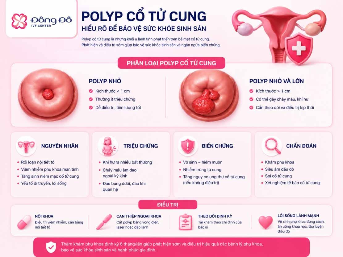 Polyp cổ tử cung