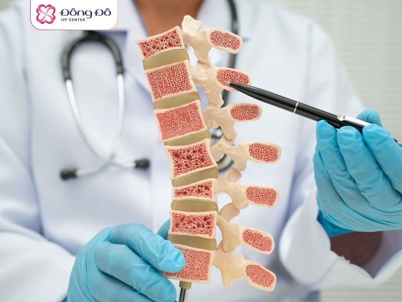 Loàng xương là biến chứng nghiêm trọng nhất về thể chất khi mắc suy buồng trứng