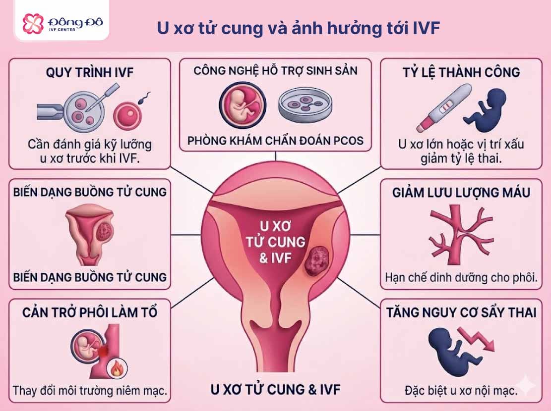 U xơ tử cung ảnh hưởng đến IVF như thế nào?