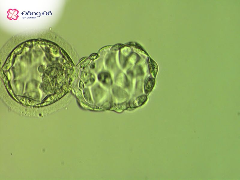 Phôi ngày 5 -phôi nang/blastocyst có tỷ lệ làm tổ thành công đáng kể so với phôi ngày 3