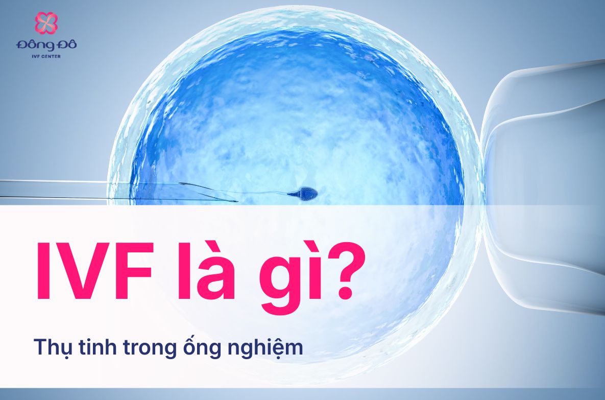 ivf là gì