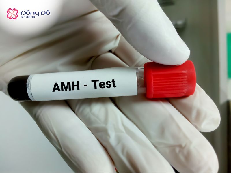 Kết quả xét nghiệm AMH là thông tin quan trọng để bác sĩ đưa ra quyết định điều trị IVF