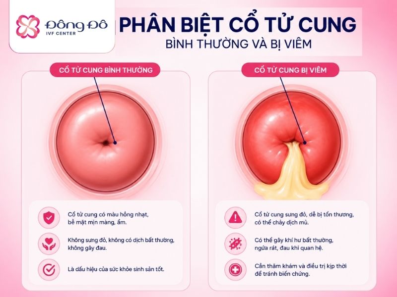 Phân biệt viêm cổ tử cung và cổ tử cung bình thường