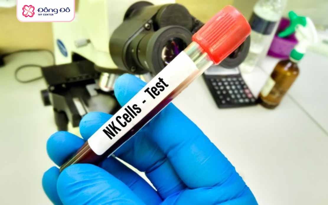 xét nghiệm nk trong ivf là gì