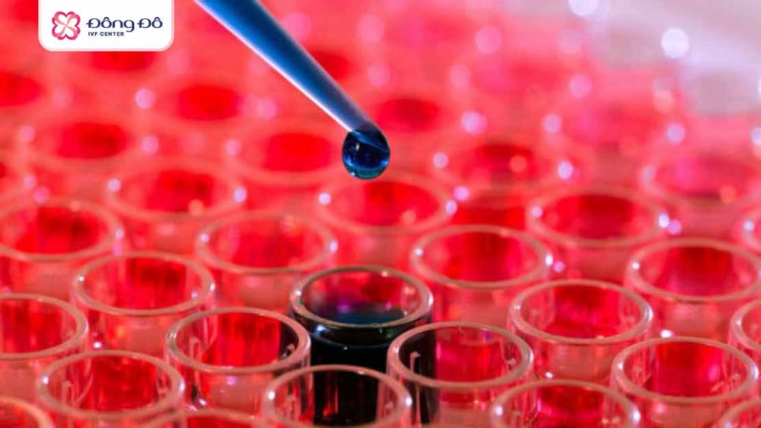 Có thể xét nghiệm NK qua lấy máu, hoặc sinh thiết niêm mạc tử cung (trong IVF)