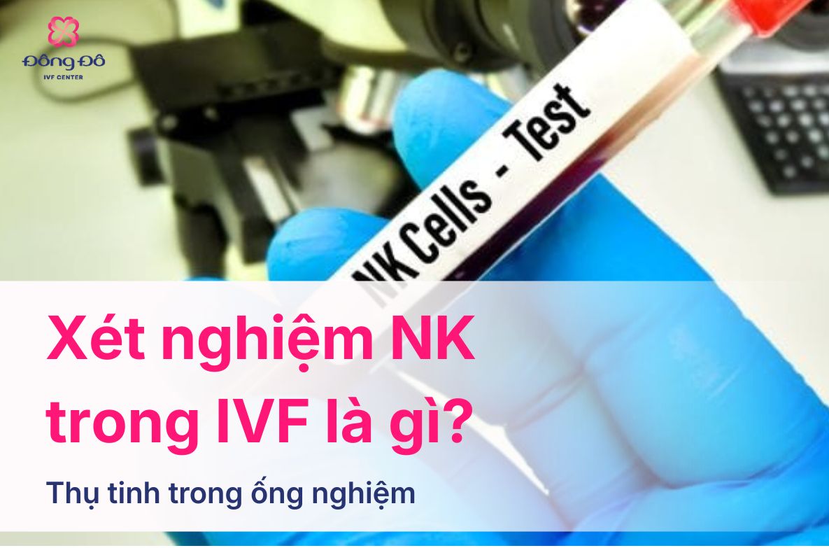 Xét Nghiệm NK Trong IVF Là Gì? Vai Trò, Quy Trình Và Cách Đọc Kết Quả