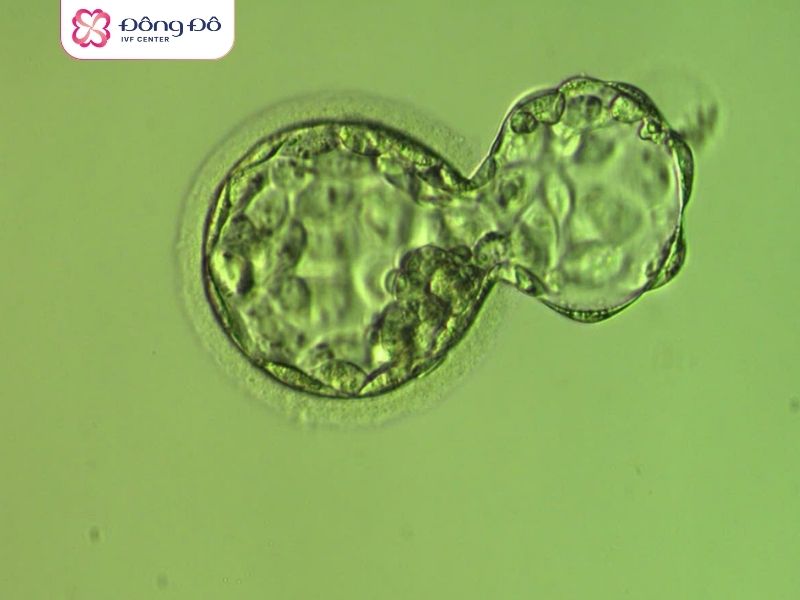Hình ảnh phôi nang -blastocyst (ngày 5) 