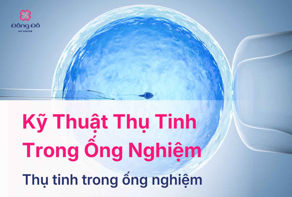 5 Nhóm Kỹ Thuật Thụ Tinh Trong Ống Nghiệm Hiệu Quả