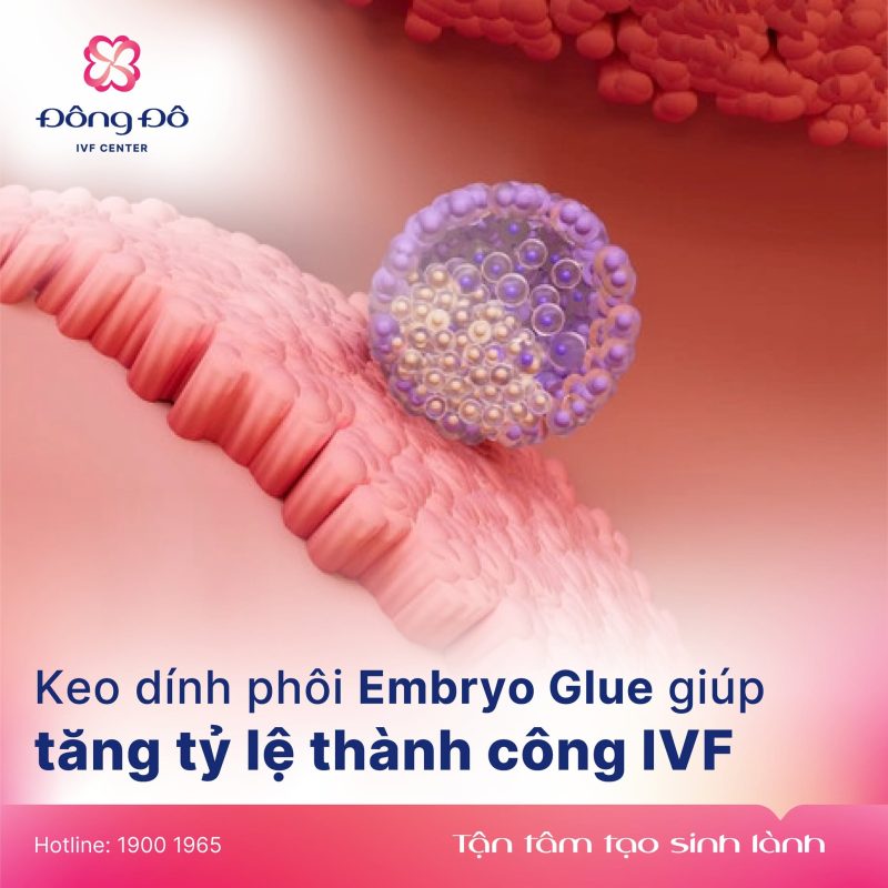 Embryo glue - keo dính phôi được áp dụng cho tất cả các trường hợp điều trị tại Đông Đô IVF Center
