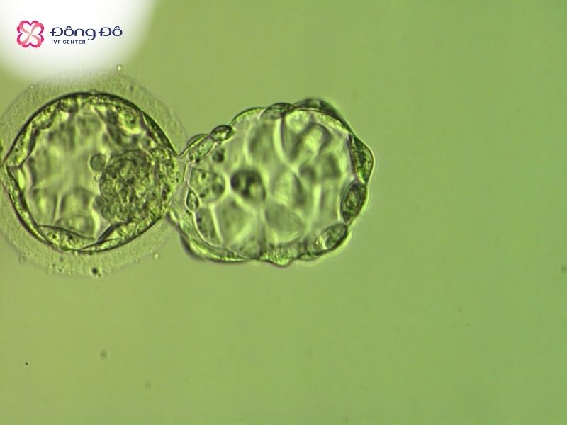 Những phôi ngày 5 (blastocyst - phôi nang) có đủ điều kiện để lấy một số tế bào sử dụng cho sinh thiết phôi (embryo biopsy)