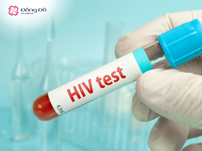 Thực hiện xét nghiệm HIV là bước bắt buộc