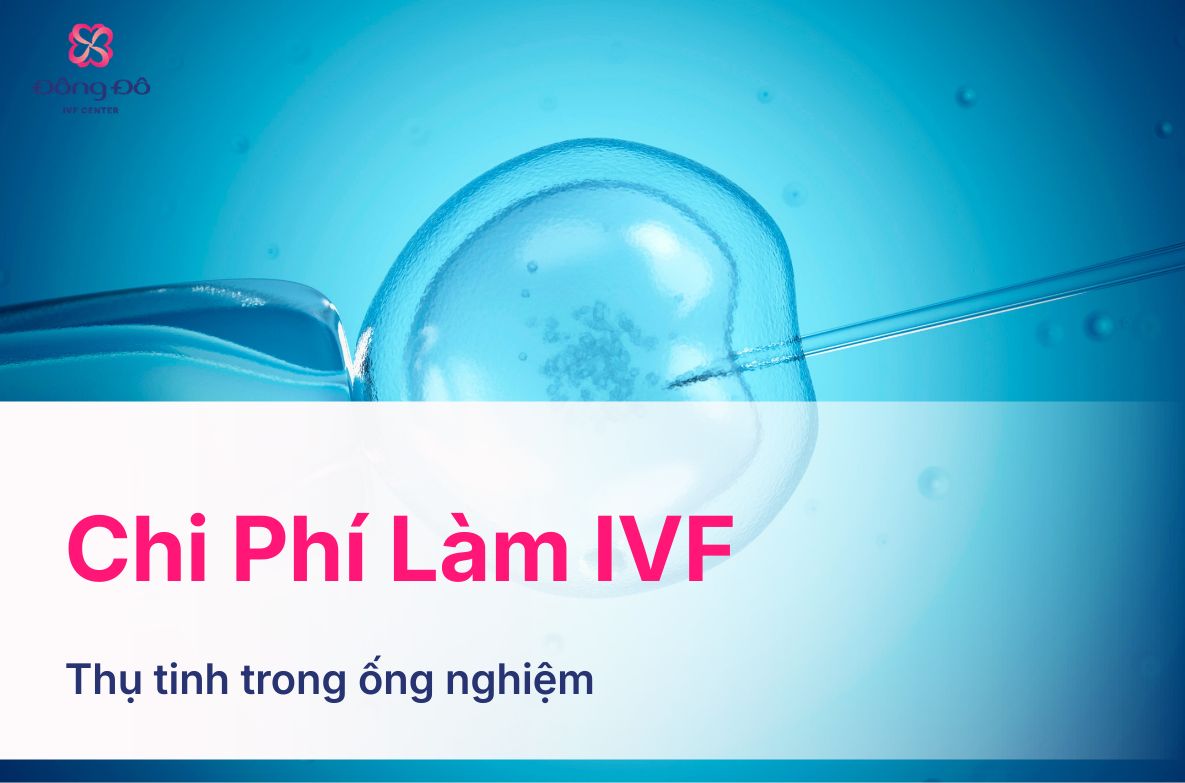 chi phí ivf