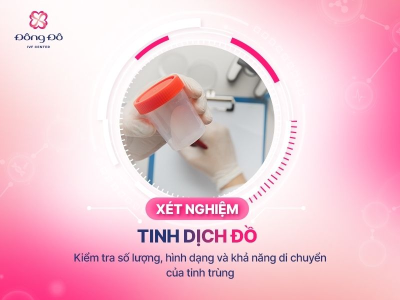 Xét nghiệm tinh dịch đồ là một xét nghiệm căn bản đánh giá sức khỏe sinh sản nam giới