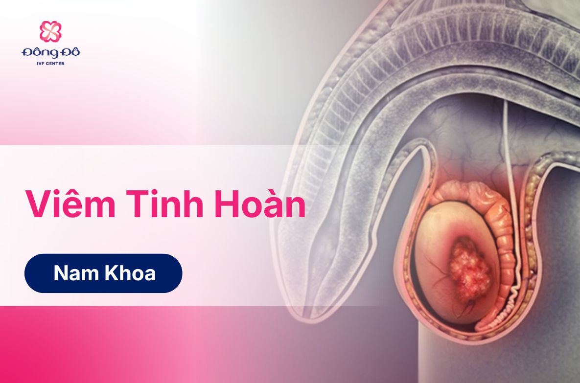 Viêm Tinh Hoàn: Nguyên Nhân Và Dấu Hiệu Vô Sinh