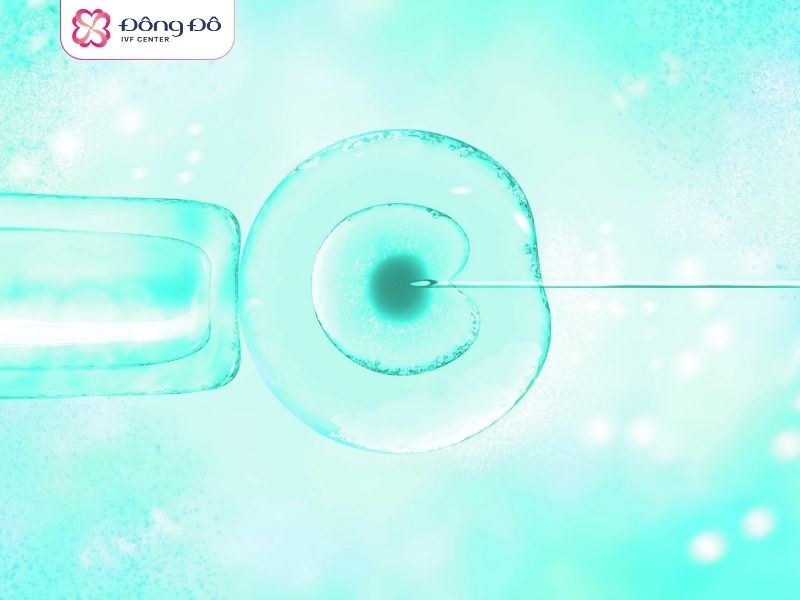 IVF ICSI, PIEZO ICSI giúp tiêm tinh trùng vào noãn, hỗ trợ quá trình thụ tinh