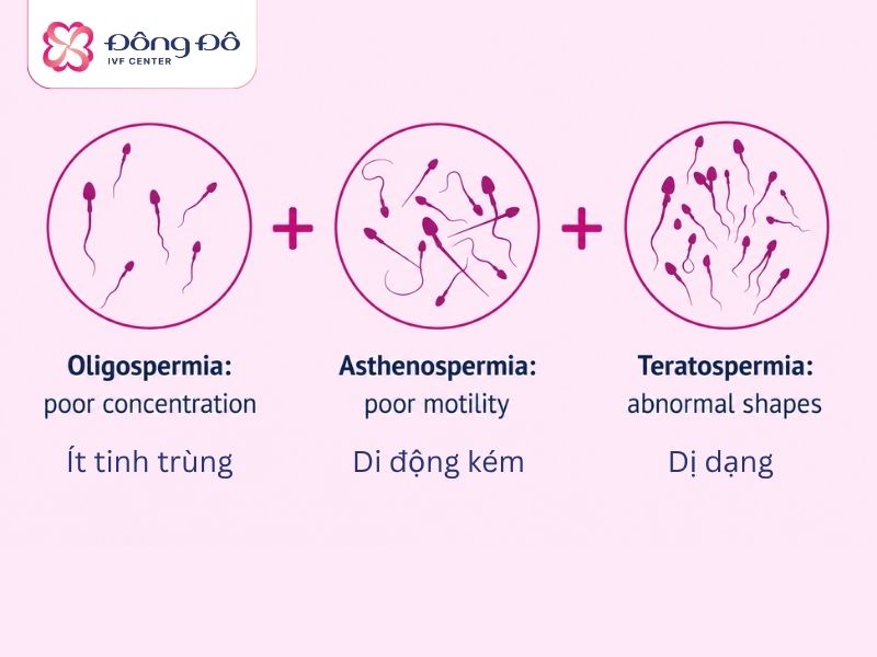 Hội chứng tinh trùng OAT là một nguyên nhân dẫn đến vô sinh nam giới nghiêm trọng nhất
